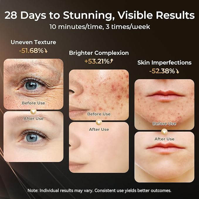 Red Light Therapy Mask for Face,USB C Rechargeable,Infrared Light Therapy Mask for Home Working Travel Yoga Sleep LED Silicone Mask