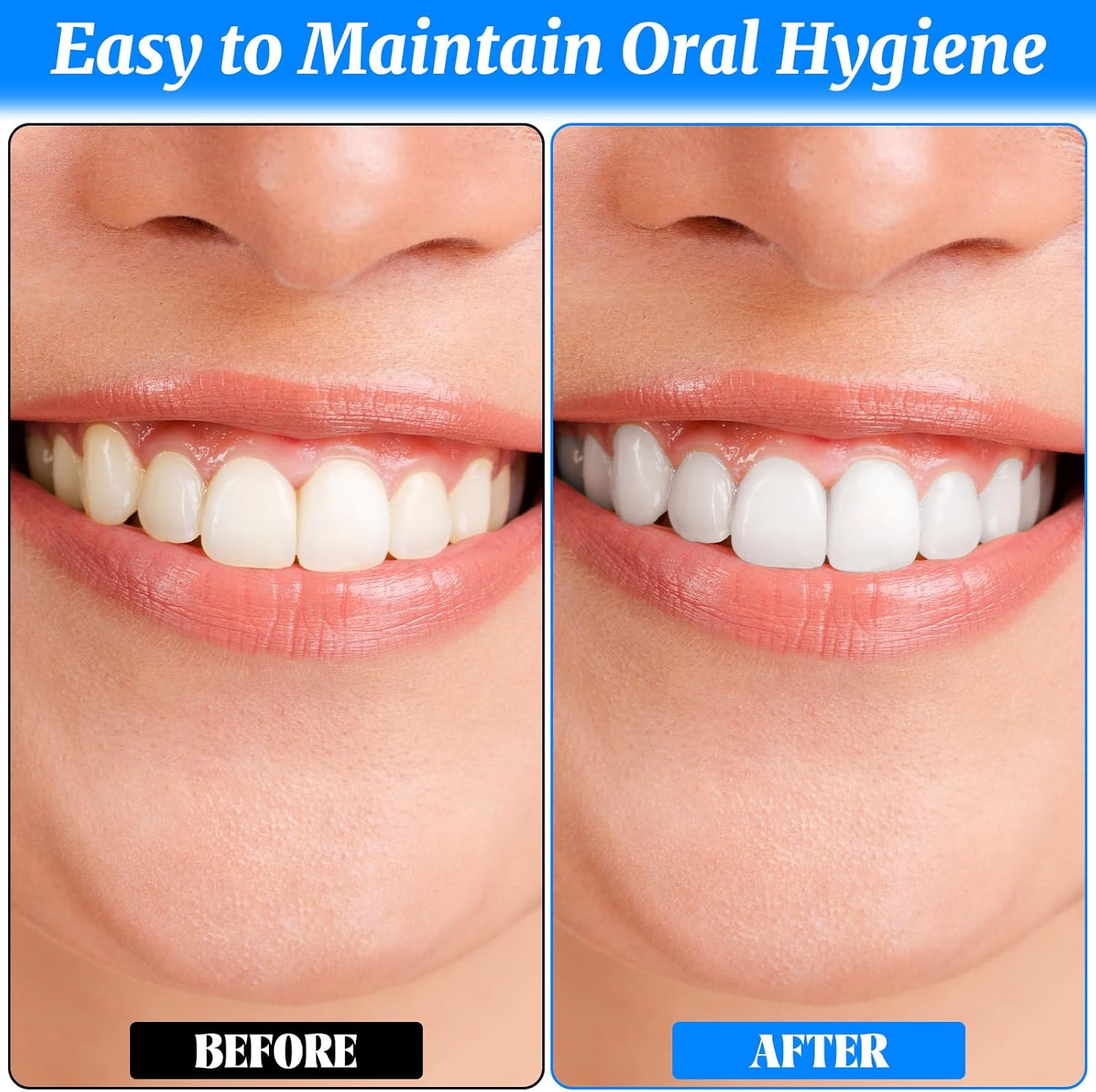 4 PCS Dental Tooth Stain Eraser Removers, Dental Plaque Tartar Eraser Polisher Professional Dental Picks Tooth Polisher and Plaque Remover for Teeth Whitening Polishing Adult Oral Care (4 Color)