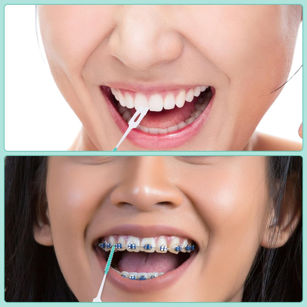 160 Pieces Dual Purpose, Dual-Use Interdental Brushes Silicone Disposable Dental, Premium Dental Floss 360° Bendable Braces Brush Brushes for Effective Teeth Cleaning