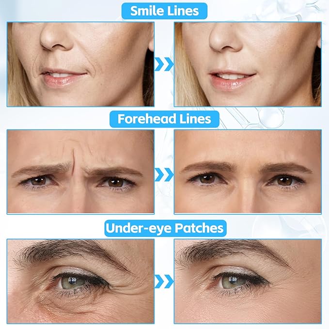 10 PCS Facial Wrinkle Patch, Forehead Moisturizing Patch for Smooth Smile Line, Frown Line & Crows Feet, Facial Pads for Under Eyes, Lips, Forehead