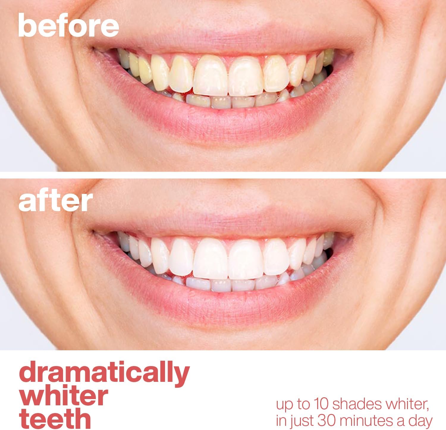 AquaSonic Professional Teeth Whitening Strips - Enamel Safe Teeth Whitening with Hydrogen Peroxide - Easy to Use, Non-Slip, Affordable & Effective (Watermelon)