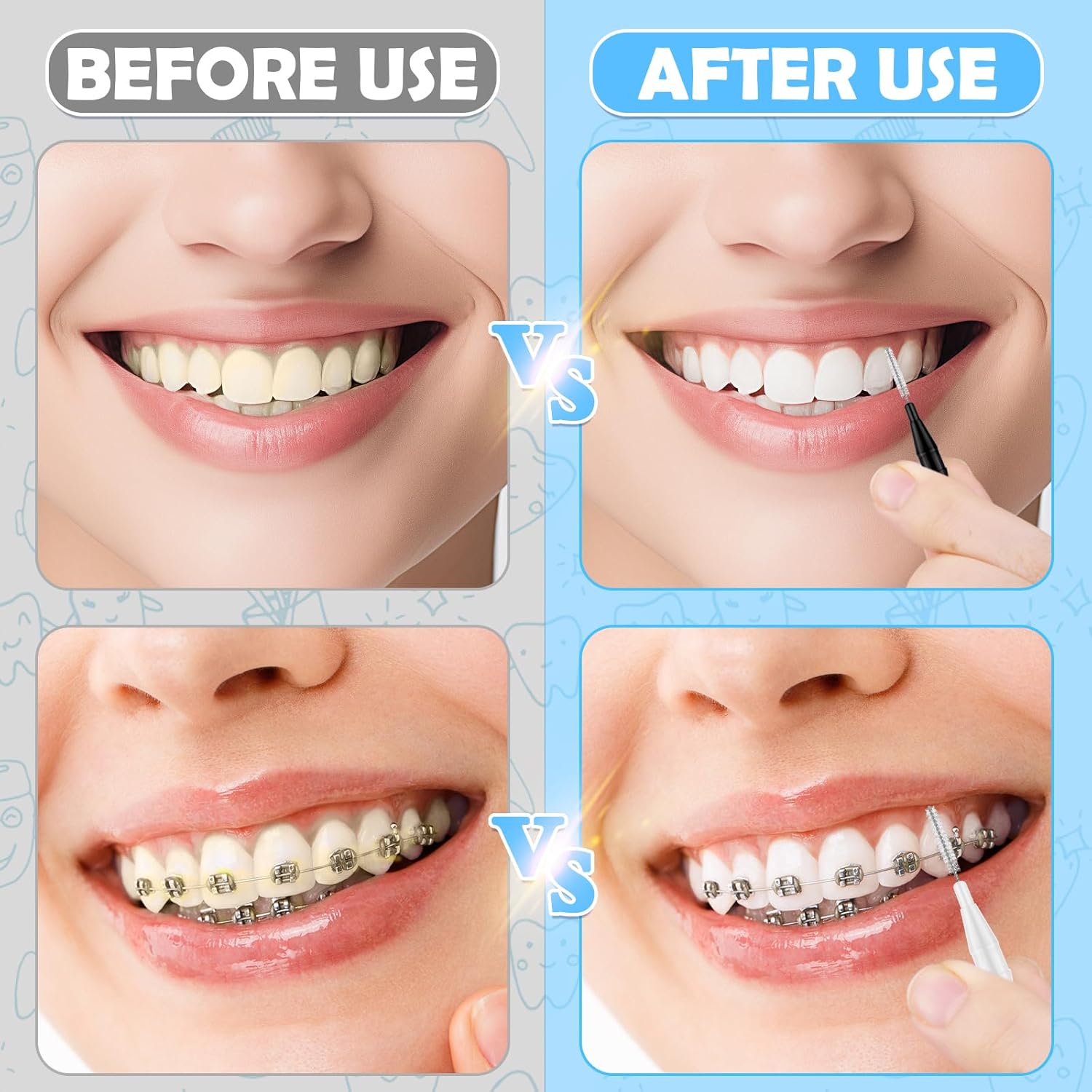 120Pcs Interdental Brushes, 360° Bendable Soft Bristles Braces Flossers Brush Dental Brushes Between Teeth Dental Floss Picks for Gum Braces Oral Teeth Cleaning Tool