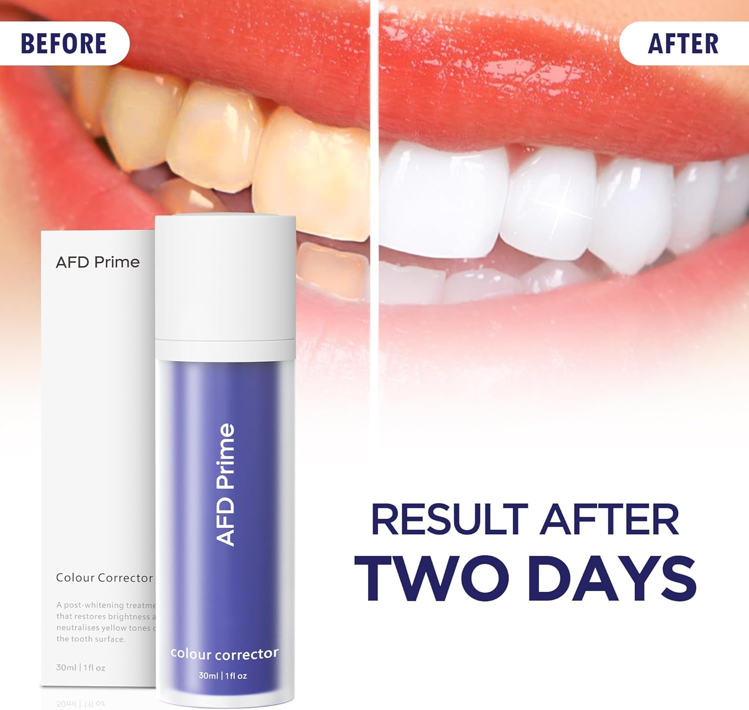 Purple Toothpaste, Teeth Stain Concealer, Teeth Whitening Booster for Yellow & Sensitive Teeth, Purple Luxe Toothpaste for Adults