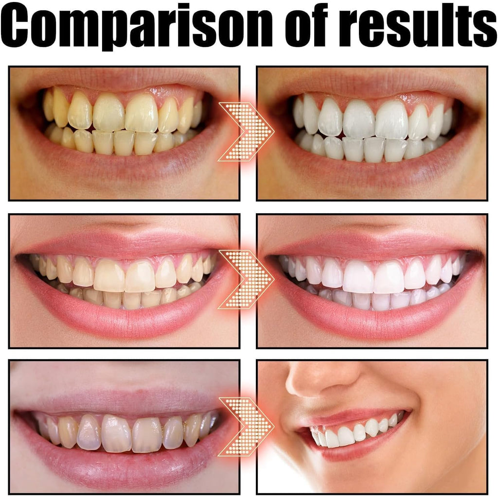 Spearmint Oil Pulling Rinse, Cold-Pressed Coconut Oil for Whitening Teeth, Peppermint Pulling Oil for Teeth and Gums, Pure Mint Mouthwash (2PCS*100ML)