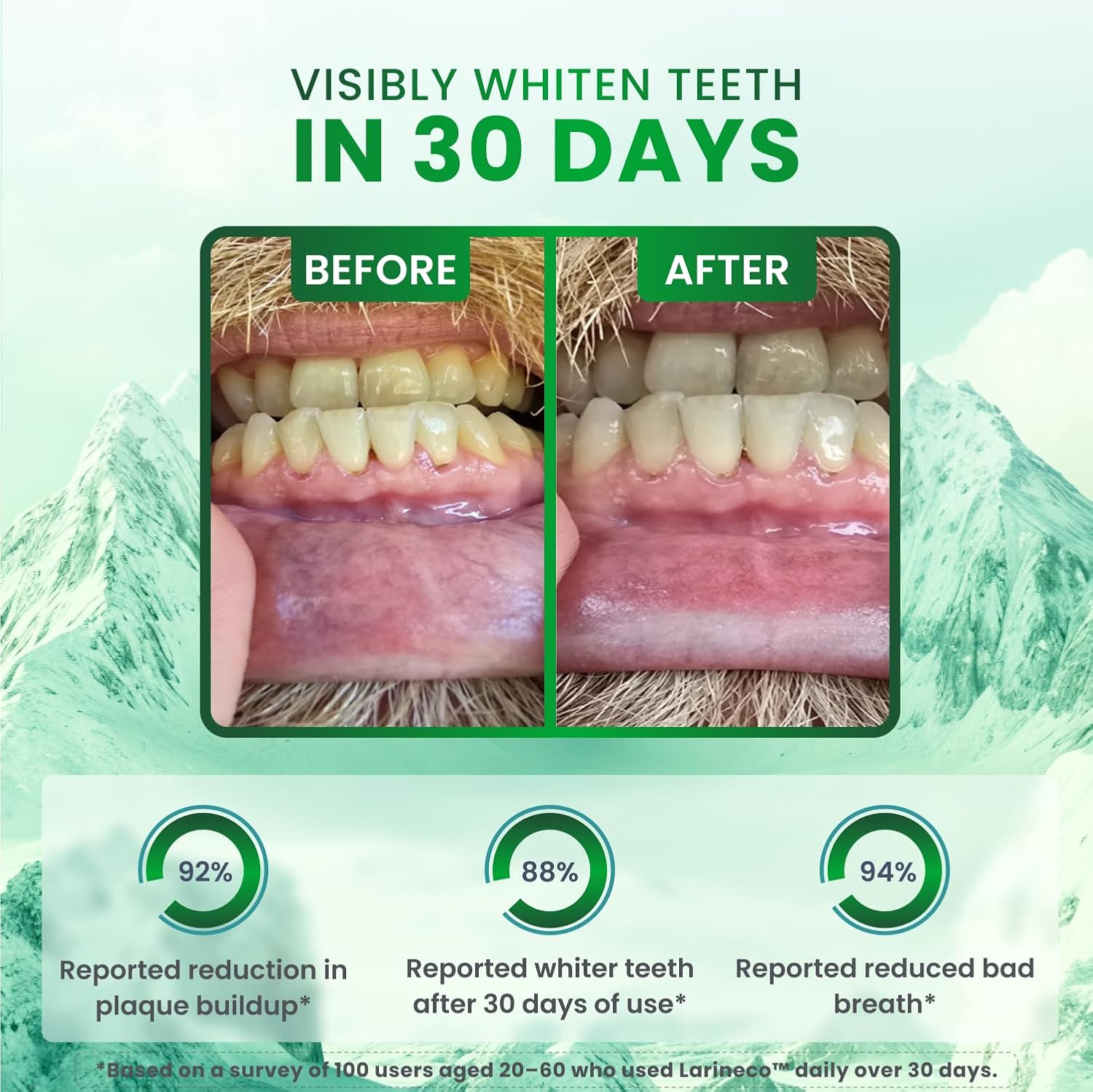 Larineco Remineralizing Gum with Nano Hydroxyapatite & Xylitol – Sugar-Free Cinnamon Xylitol Gum – Plastic-Free, Dye-Free, Aspartame-Free – Natural Base – 18 Pieces (18 Count (Pack of 2), Peppermint)