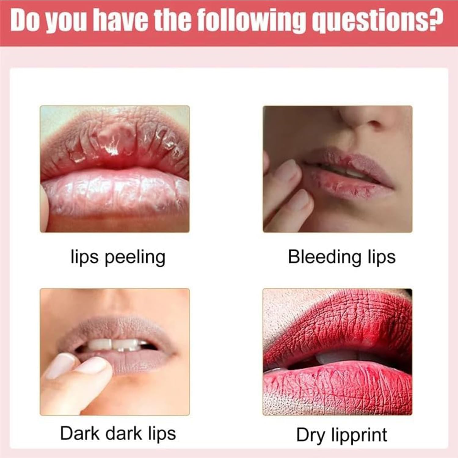 Lip Serum, Dark Lip Treatment, Lip Balm, Lip Brightening Pink Lip, Vitamin E Lip Essence, Remove Dark Lips Moisturizer for Dry Lips, Lighten Lip Lines (2pc)