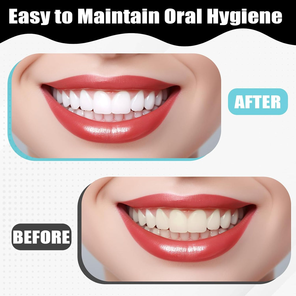 Dental Tooth Stain Removers, Dental Plaque Tool Tartar Eraser Polisher Professional Teeth Whitening Polishing Cleaning Kit for Teeth Whitening Polishing Oral Care(8PCS)