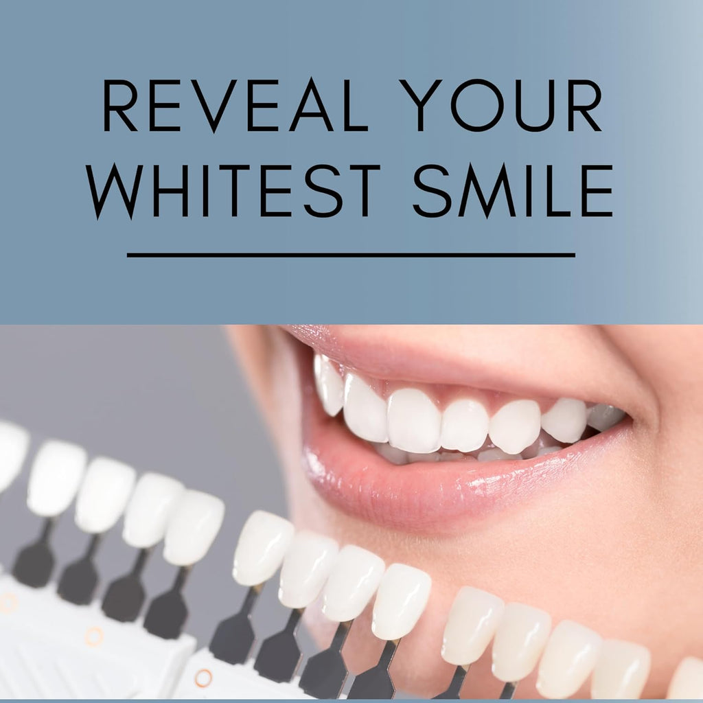 Teeth Whitening Gel for Trays - Professional Strength 44% Carbamide Peroxide, 5 Syringes (50 Treatments) + 2 Trays – Enamel Safe, Removes Coffee & Other Stains