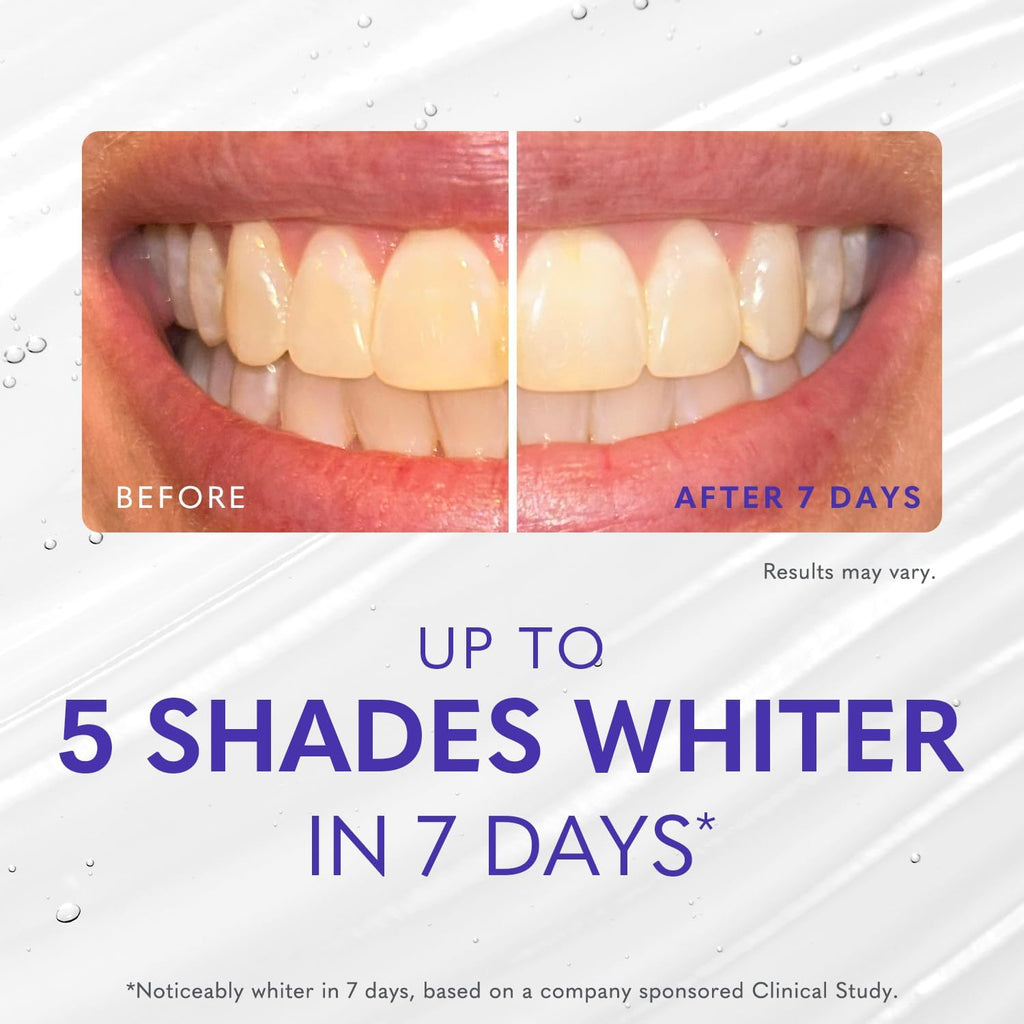 Smileactives Teeth Whitening Kit, Complete at Home Teeth Whitening Treatment, Travel Size Tooth Whitening, Stain Remover for White Teeth, Contains Clinical-Grade Hydrogen Peroxide, 30 Day Kit