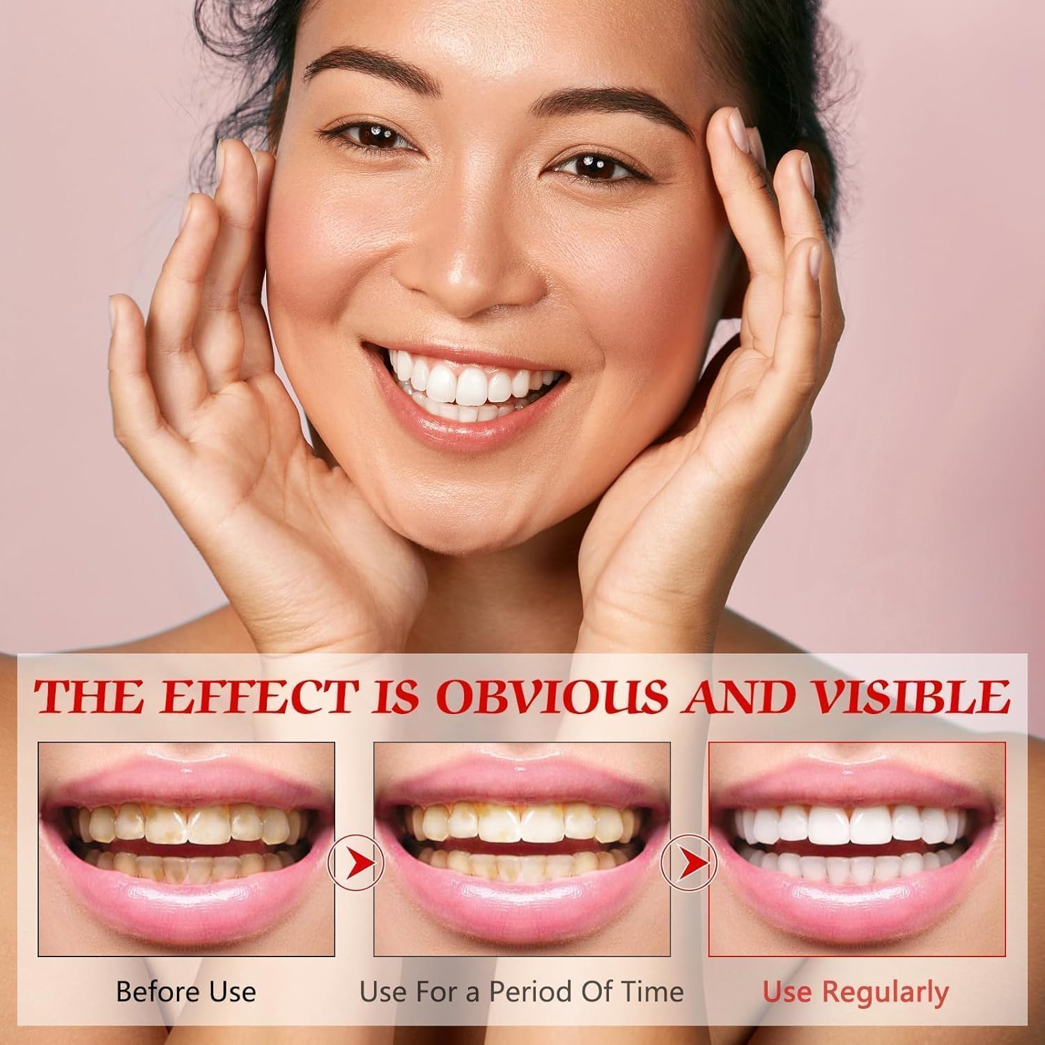 2Pcs Super ProbioticSp-8 Toothpaste, Sp 8 Pasta Dental, SP-8 Toothpaste, Pasta Dental Sp-8,SP8 Probiotic Toothpaste, Deep Cleaning Care Toothpaste