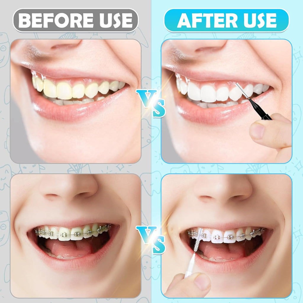 120Pcs Interdental Brush, Braces Brush Toothpicks with Soft Bristles 360° Bendable Floss Heads Dental Brushes Between Teeth Gum Braces Cleaning Kit Oral Tooth Cleaning Tool （Black, White）