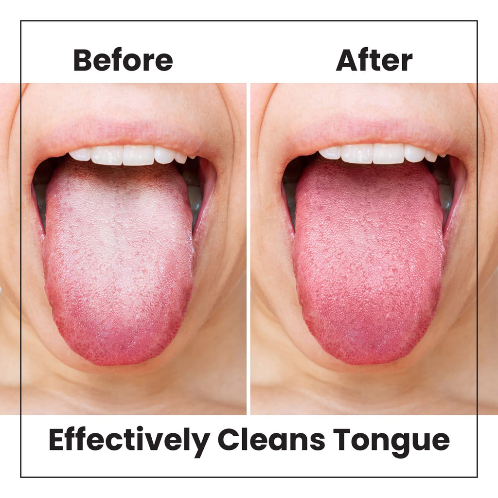 Lindo Eco-Friendly Tongue Cleaners, Tongue Scrapers, Oral Care Cleaners, Reduce Bad Breath, Soft Silicone Bristles, Natural, Vegan, 2 Pack