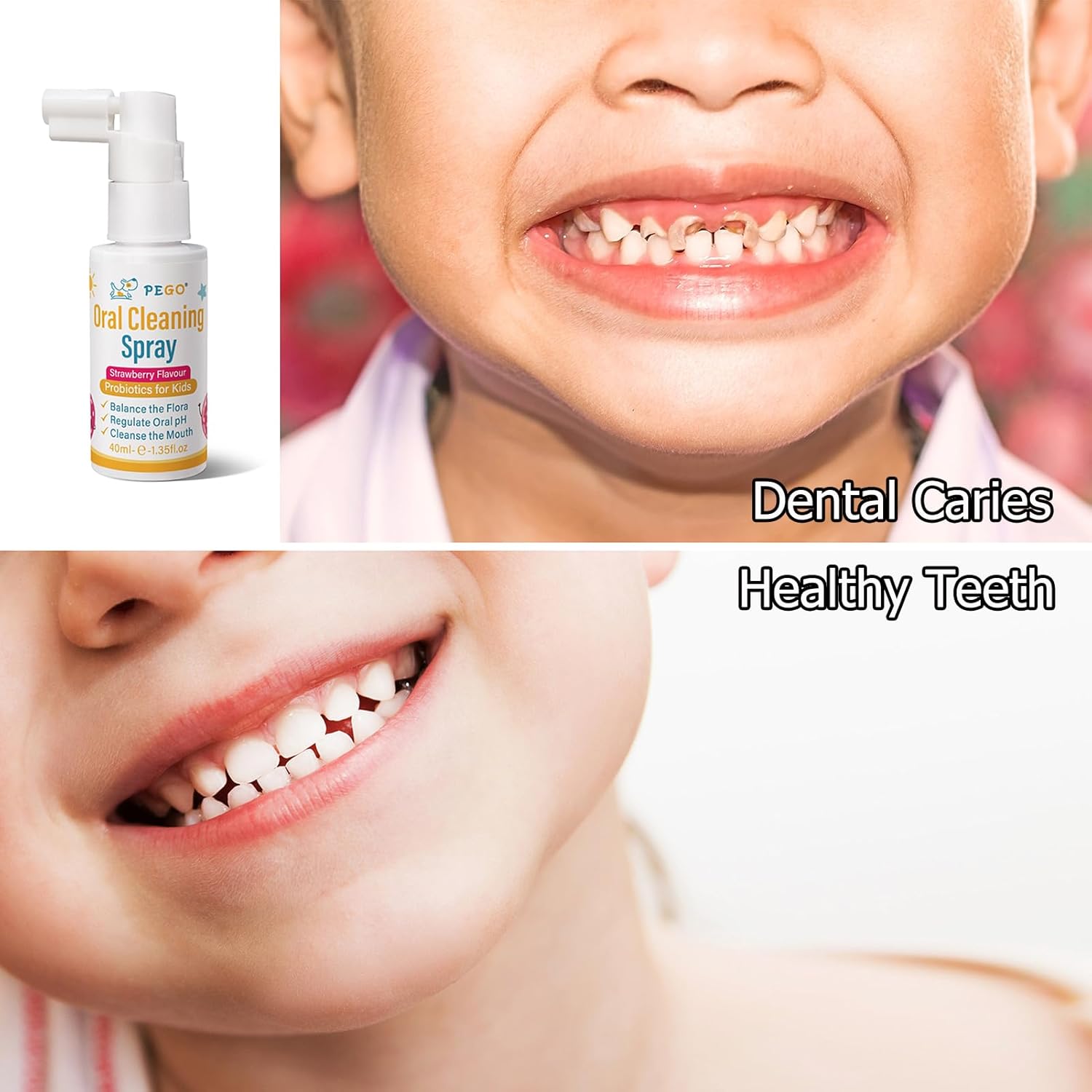 Kids Oral Spray, Toddler Toothpaste Helper for Cavity Prevention and Fresh Breath, Children Anticavity with Fluoride Free for Newborn to Preschoolers, Kid's Mouth Spray (1)