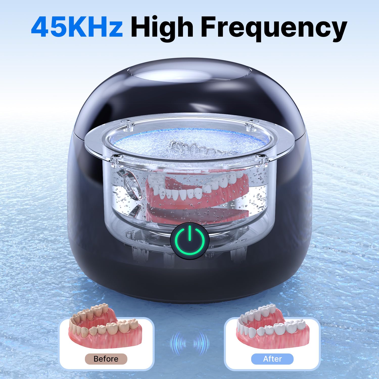 Ultrasonic Retainer Cleaner - UV Dental Cleaning Pod Night Guard Cleaner for Dentures, Aligner, Braces, Toothbrush Heads, Jewelry (Black)