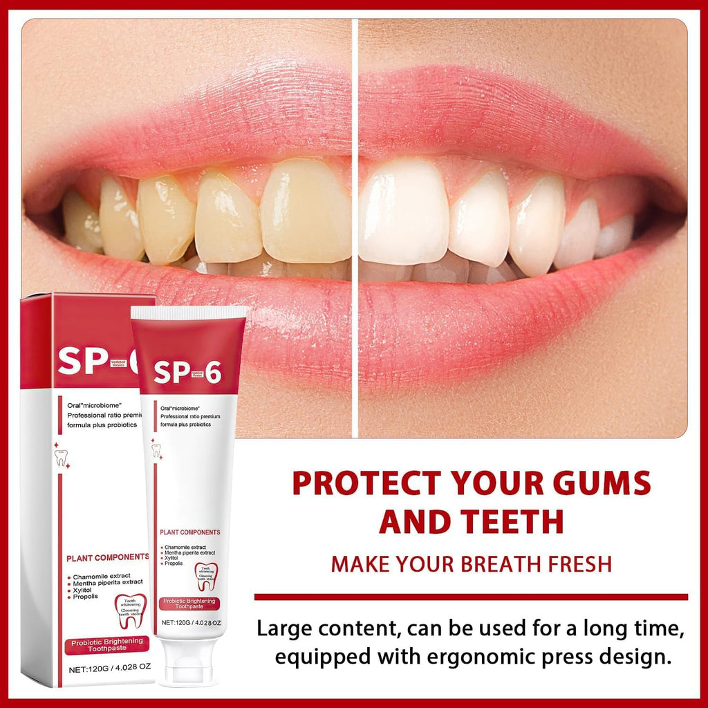 2Pcs Sp-6 Ultra Whitening, Sp-6 Probiotic Whitening Toothpaste, Deep Cleaning Care Toothpaste 120g