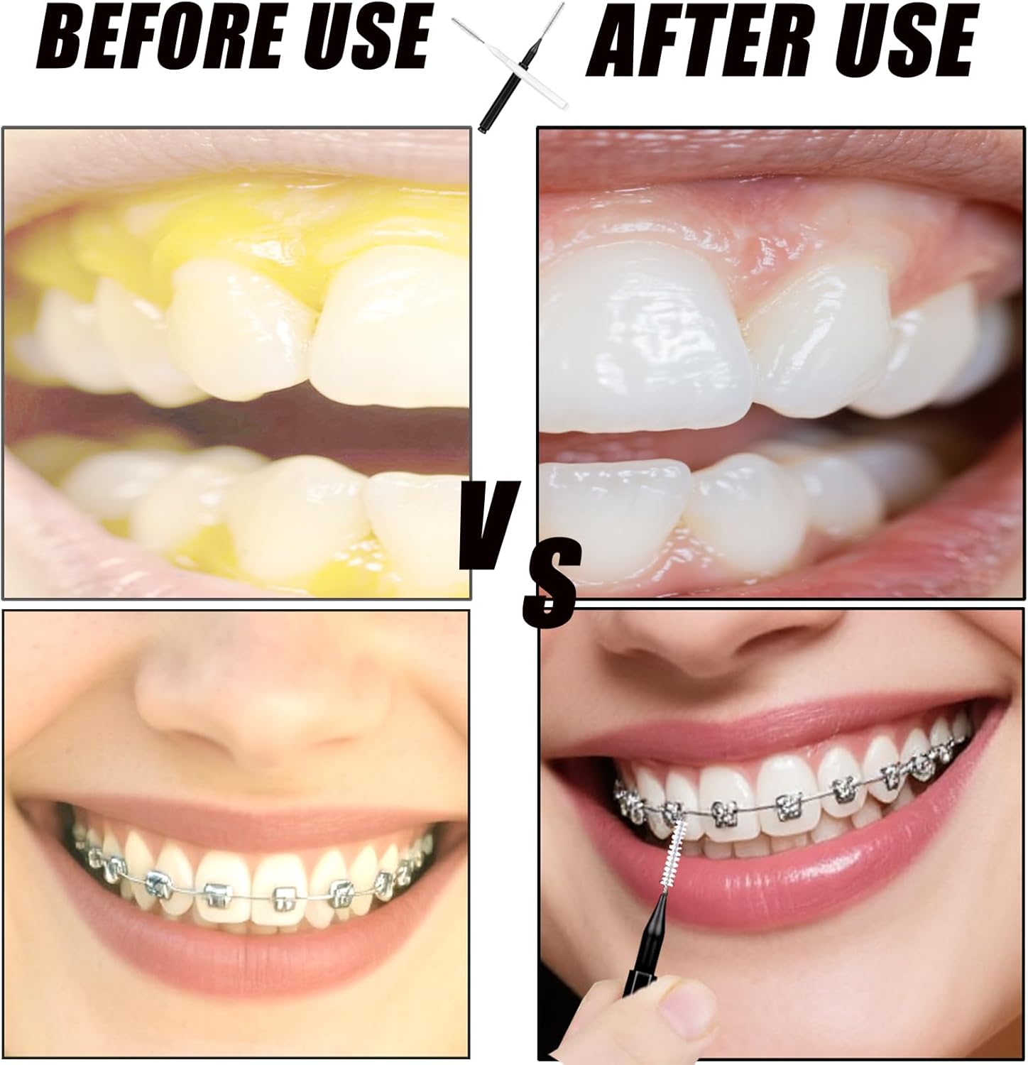 130-Count Interdental Brushes Set - Black & White Orthodontic Cleaning Kit with Spiral Brush Heads, Braces-Friendly Flossers & Toothpicks for Efficient Teeth & Braces Care