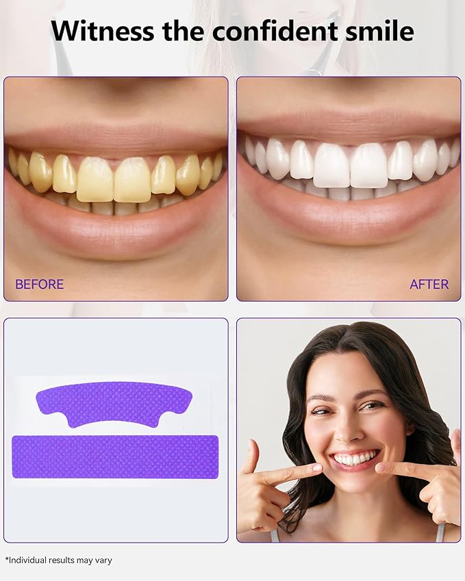 Teeth Whitening Strips 14 Treatments, Enamel Safe for Sensitive Tooth, Whitens Teeth, Purple Whitening Strips, Removes Yellow Stains & Bad Breath - Effective Color Correction for a Brighter Smile