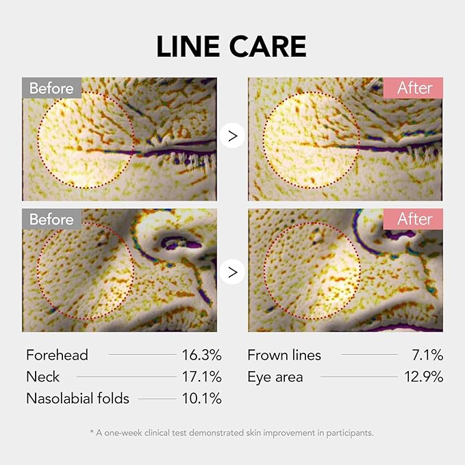 107% Crow’s Feet Improvement, 117% on Neck Lines & 109% on Nasolabial Lines – Boosts Elasticity – With Botulinum-Inspired Peptide and Collagen – Korean Skincare Korea’s Best Skincare Stick Kioskin