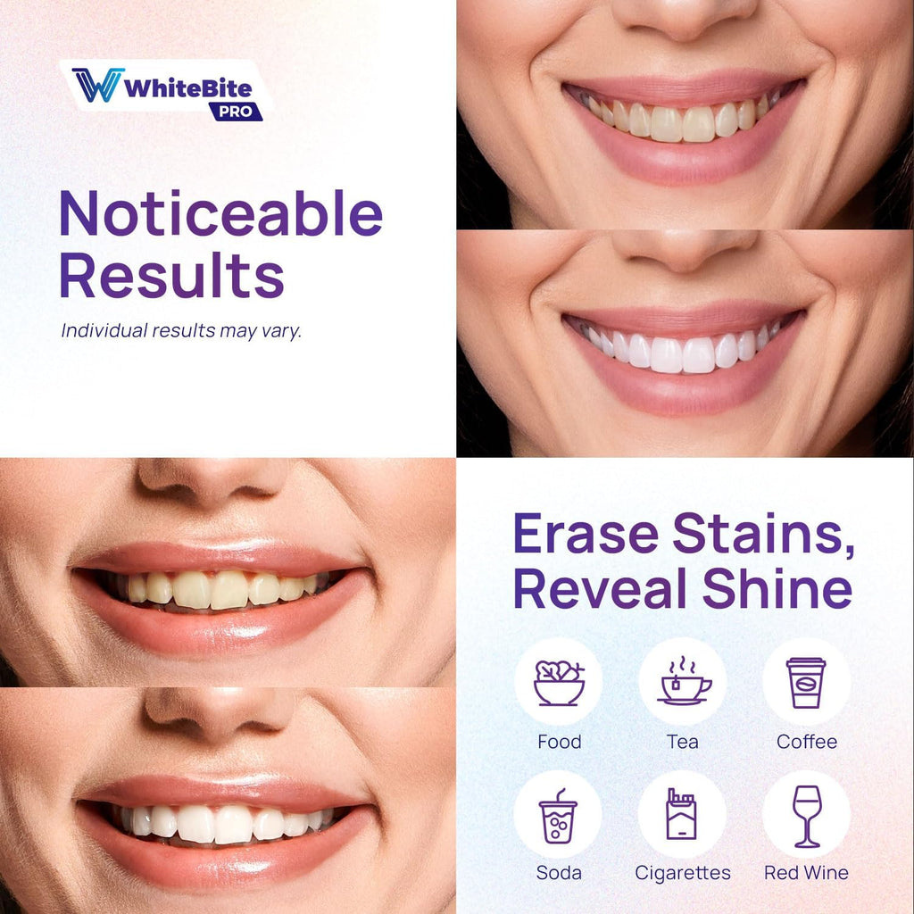 Whitebite Pro Purple Teeth Whitening Strips, 28 Strips (14 Treatments), Enamel-Safe, with Pap, V34 Color Corrector, Hydroxyapatite for Enamel Care, Non-Slip Design