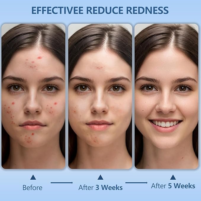 Disposable Face Towels, 12"×12" Extra Large Face Towelettes, Ultra Soft Facial Towels for Sensitive Skin, Makeup Remover Dry Wipes, 165 Count (3 Packs of 55)