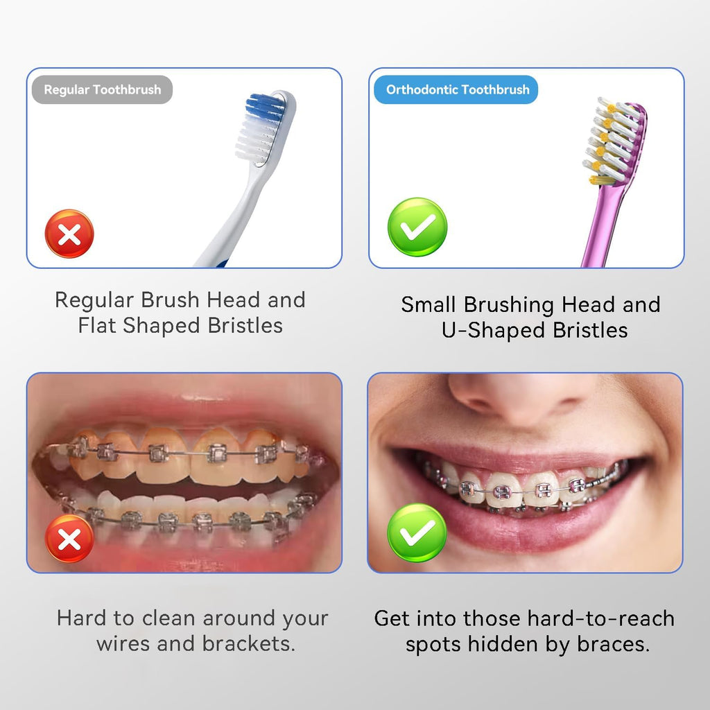 JTF Orthodontic Manual Toothbrush for Braces: 6 U-Shaped Tooth Brush with 6 Interdental Brushes, Ultra-Durable Bristles for Stain Removal and Deep Oral Clean, Toothbrushes for Tooth with Dental Device
