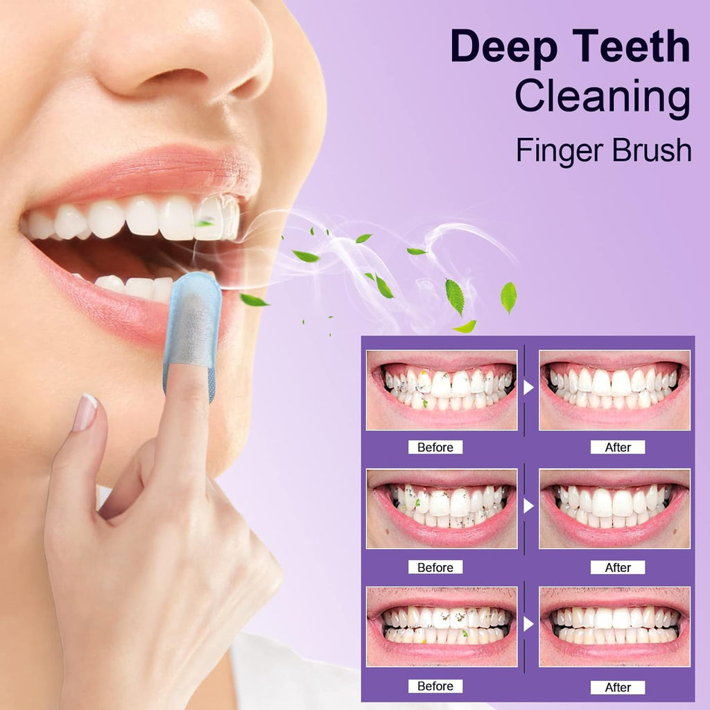 MySmile Teeth Wipes 100pcs Disposal Finger Brush Deep Cleaning Wipes Oral Brush Ups Tooth Wipes For Teeth Cleaning, Oral Freshes Mint Flavor