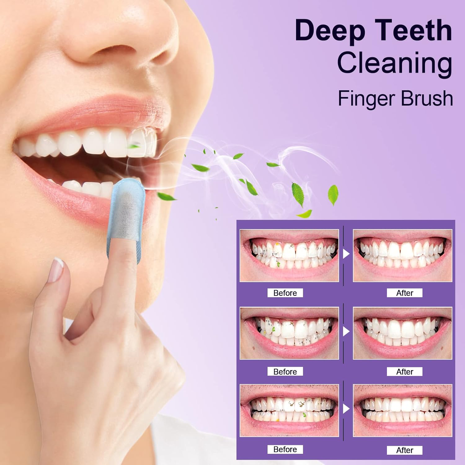 MySmile Teeth Wipes 100pcs Disposal Finger Brush Deep Cleaning Wipes Oral Brush Ups Tooth Wipes For Teeth Cleaning, Oral Freshes Mint Flavor