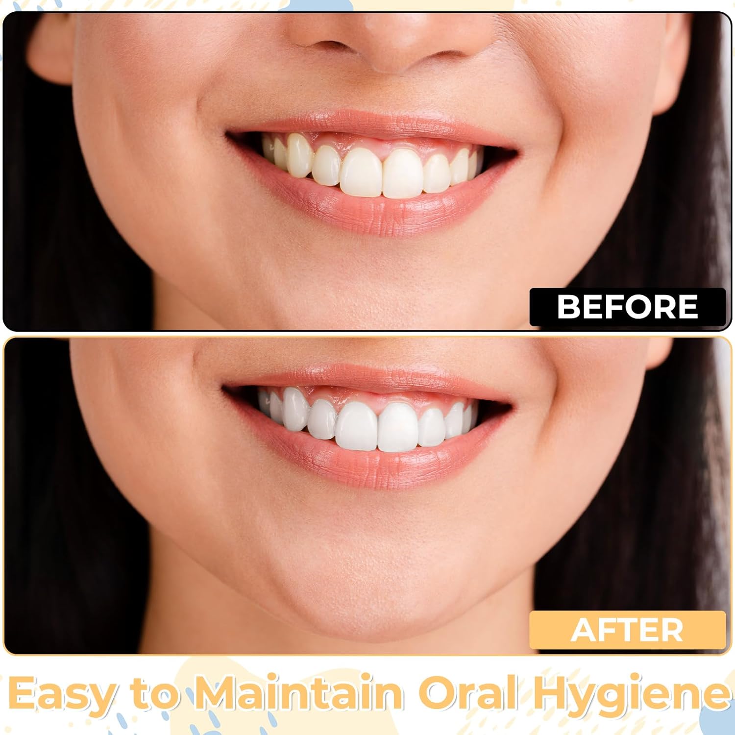 4 Pcs Tooth Stain Eraser Removers Dental Plaque Tartar Eraser Polisher Professional Dental Picks Tooth Stain Remover Tool For Teeth Whitening Polishing Adult Oral Care (4 Color)