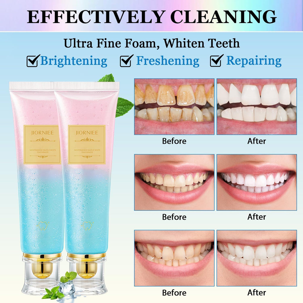 2PCS Niacinamide Toothpaste, Niacinamide Whitening Toothpaste, Niacinamides Intensive Whitening Toothpastes, Fresh Breath, Remove Tooth Stains