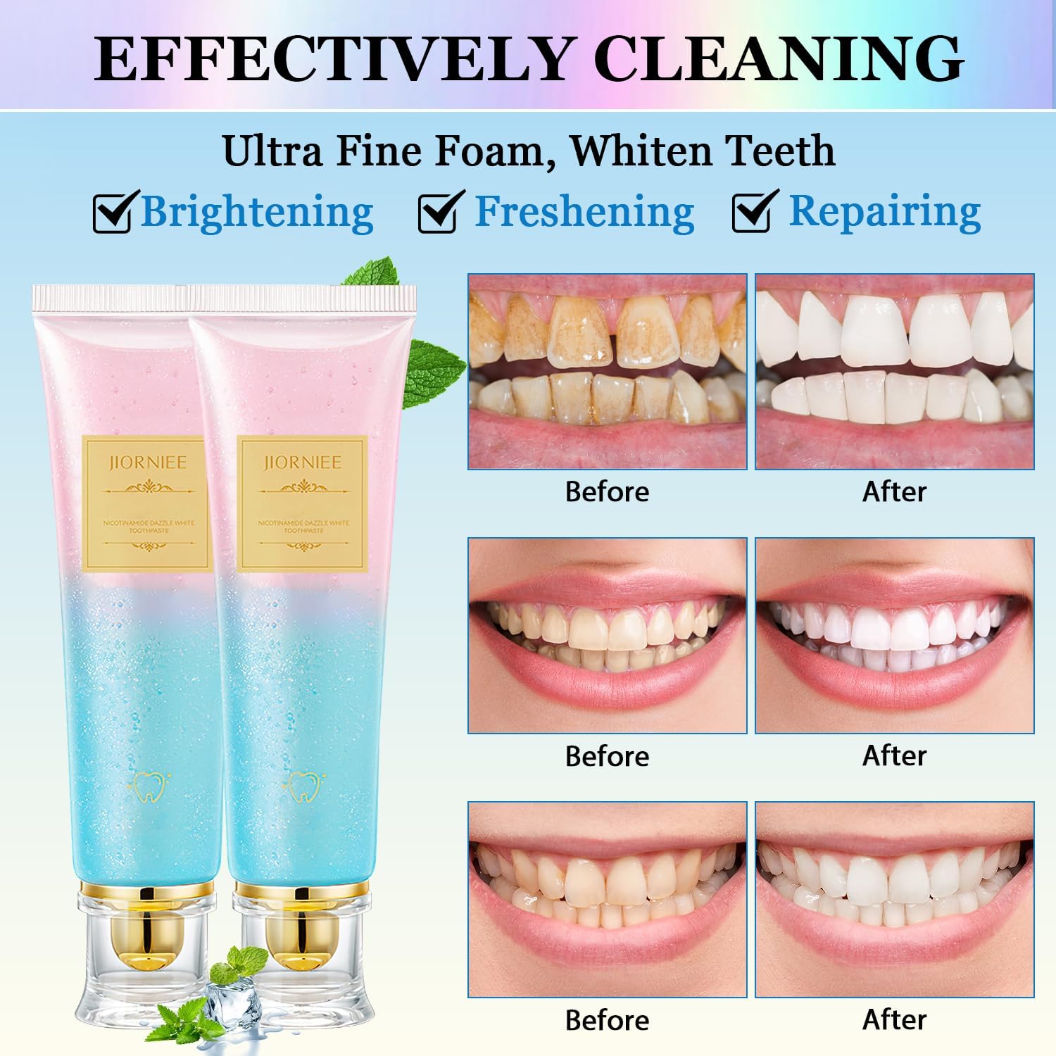 2PCS Niacinamide Toothpaste, Niacinamide Whitening Toothpaste, Niacinamides Intensive Whitening Toothpastes, Fresh Breath, Remove Tooth Stains