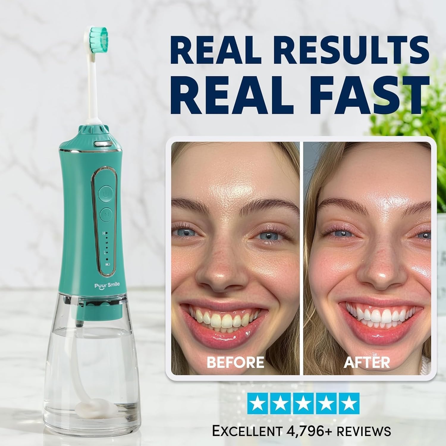 Professional Water Flosser - Advanced Dental Care for a Healthier Mouth, Gum, and Teeth - IPX7 Waterproof Oral Irrigator | 7 Replacement Tips, Travel-Friendly, Rechargeable - Oral Hygiene (Green)