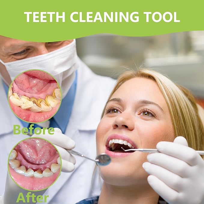 11 Pack Dental Tools PARYUNGR Teeth Cleaning Tool Kit, Stainless Steel Tongue Scraper Tartar Plaque Remover Tooth Cleaner Dental Floss Picks Mouth Mirror, Professional Oral Care Hygiene Set with Case