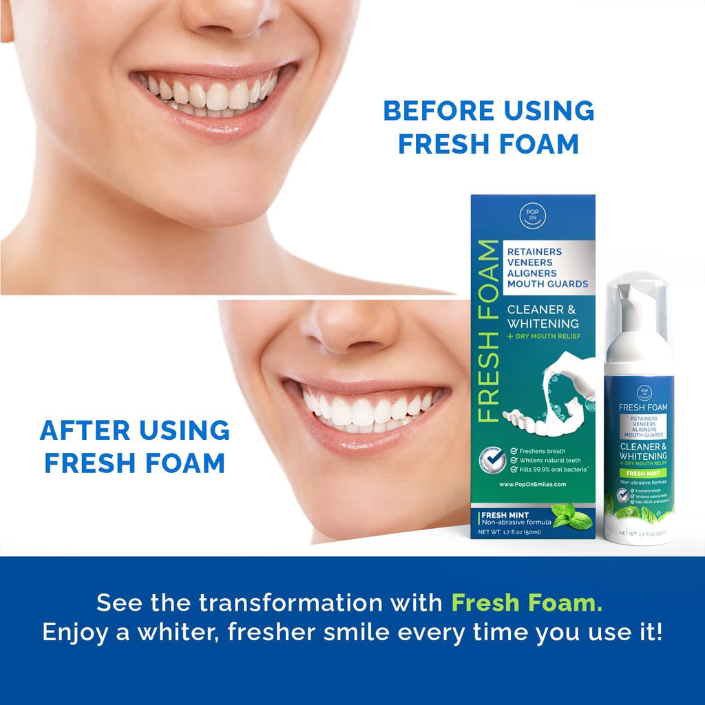 Aligner & Retainer Cleaner Fresh Foam – Dry Mouth Relief, Compatible with All Clear Aligners, Retainers, Mouth Guards, Night Guards, Veneers, Whitens, Freshens, 3% Hydrogen Peroxide, Mint - 50ml 3pcs