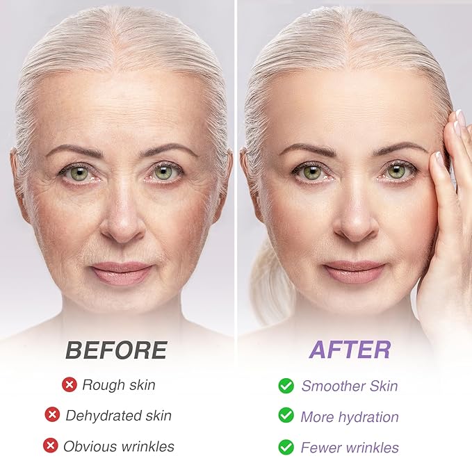 108PCS Smile Line Wrinkle Patches, Facial Frown Crows Feet Wrinkle Patches