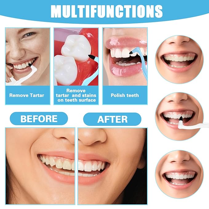 8 Pcs Tooth Stain Eraser Tartar Polisher Stain Removers Dental Plaque Tartar Eraser Plaque Tool Professional Dental Picks Cleaning Professional Tools for Oral Care （lBlue White Yellow Gray）