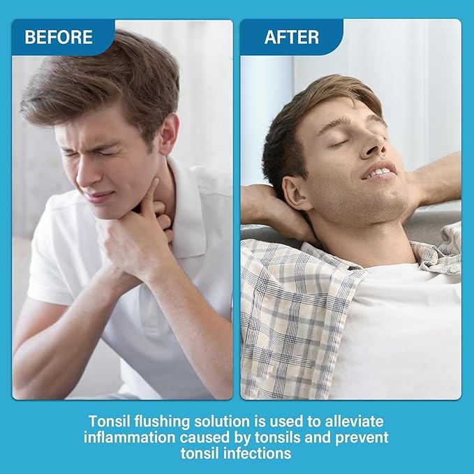 Tonsil Stone Mouthwash, Tonsil Stone Remover Rinse Liquid Help Soothe Tonsils, Mint Flavor Mouthwash Freshen Breath, Eliminate Oral Odor, 100ML