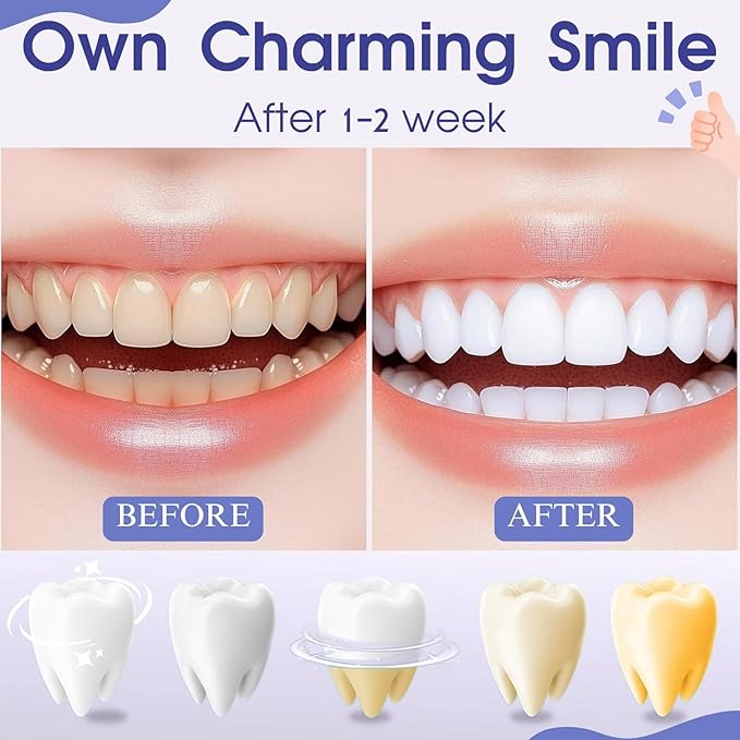 Teeth Whitening Pen, Teeth Whitener Kit Tooth Whitening Pen Gel Effective for Professionally Stain Removal, Portable, Painless, 2-Pack