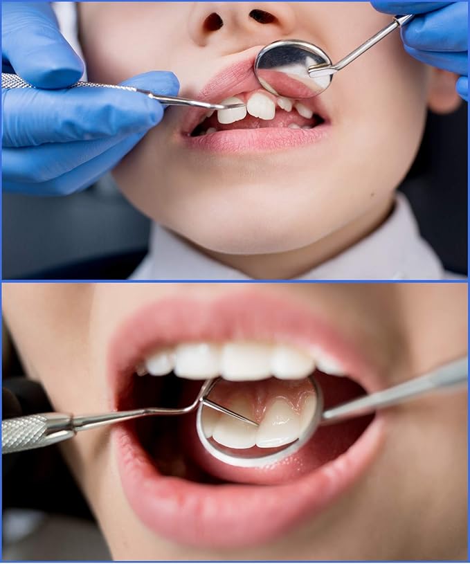 Professional Dental Hygiene Kit | Dentists Tools for Calculus & Plaque Removal | Stainless Steel Tarter Scraper, Probe, Scaler, Tweezers, Mouth Mirror and Free Protective Case for Humans and Pets