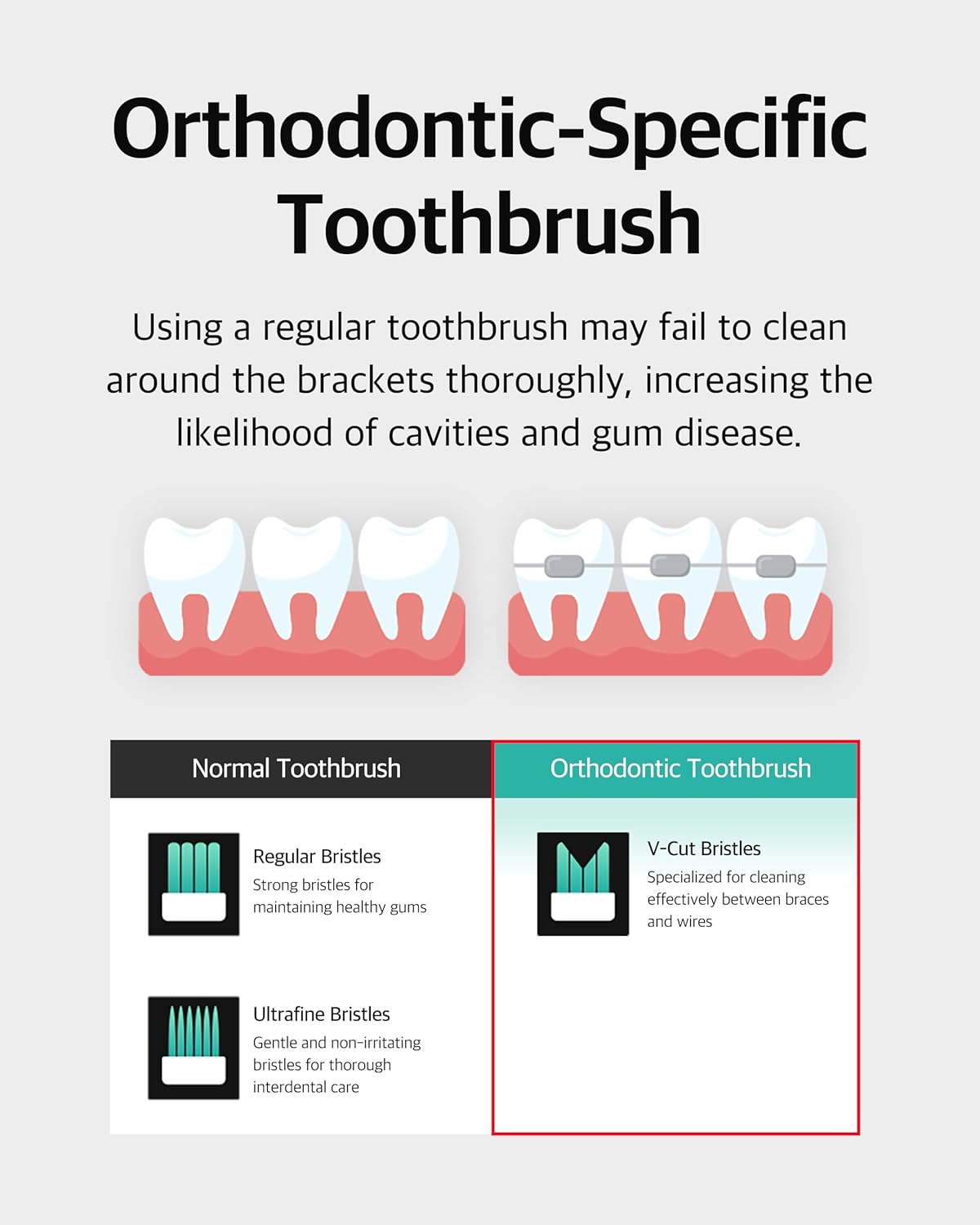 V-Cut Orthodontic Toothbrush(Mint, White) - Compact Head for Braces, Ergonomic Handle, Deep Cleaning, Gentle Bristles for Brackets and Wires