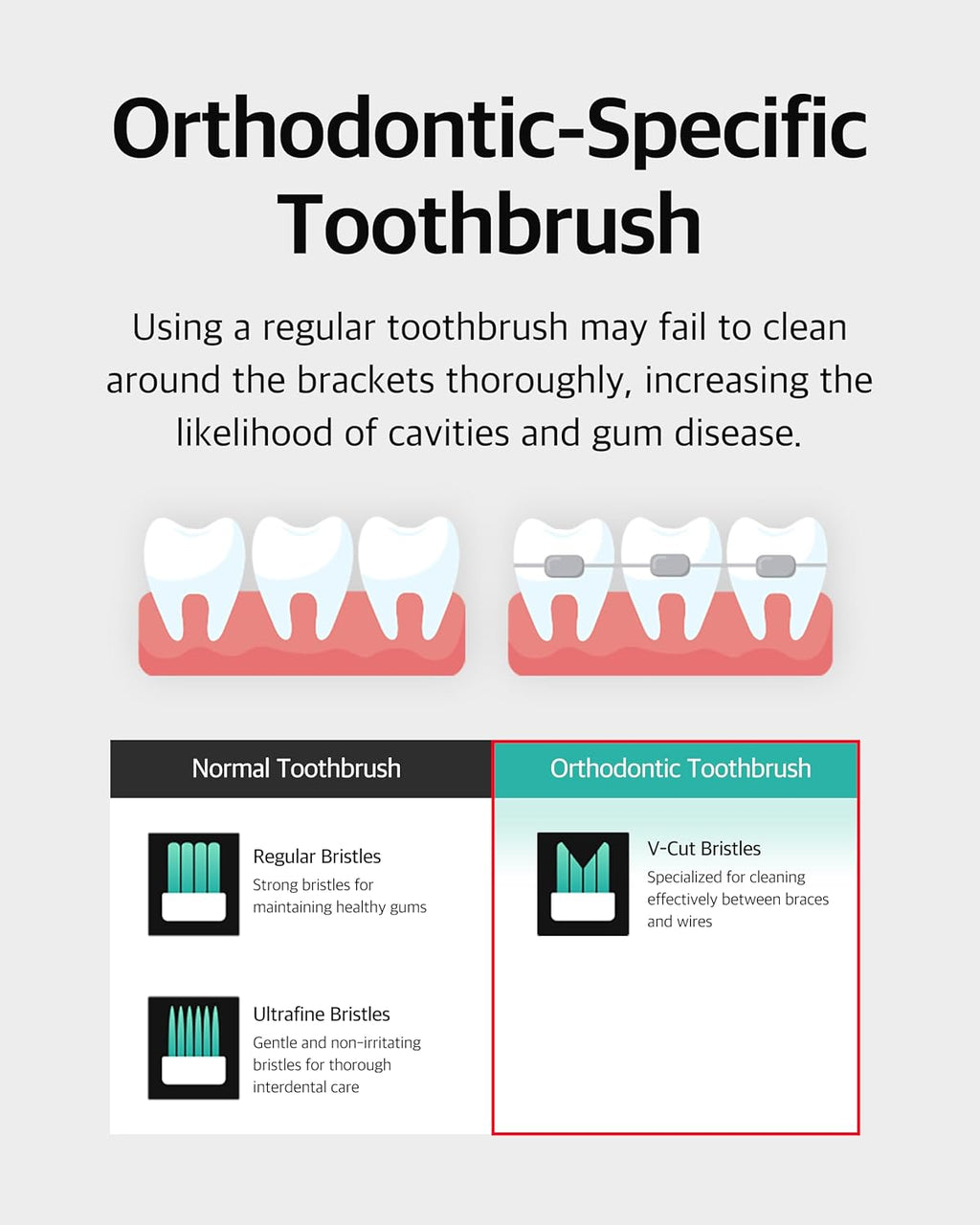 V-Cut Orthodontic Toothbrush (Mint) x 6Units – Medium Bristles, Ergonomic, Travel-Friendly Manual Toothbrush for Adults