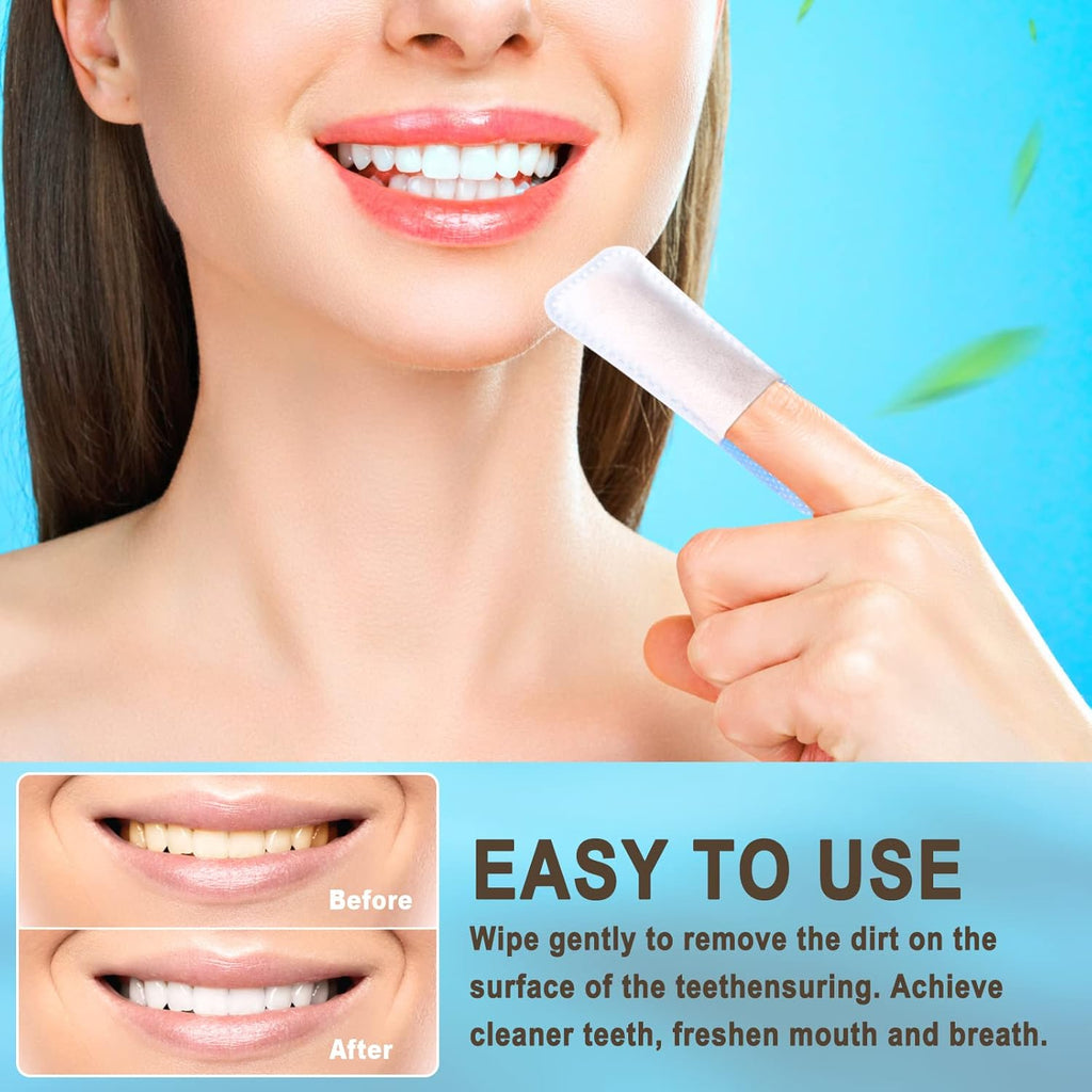 Mint-Flavored Oral Finger Wipes Teeth Whitening Wipes Oral Cleaning Wipe(Light Blue, 60 Pcs)