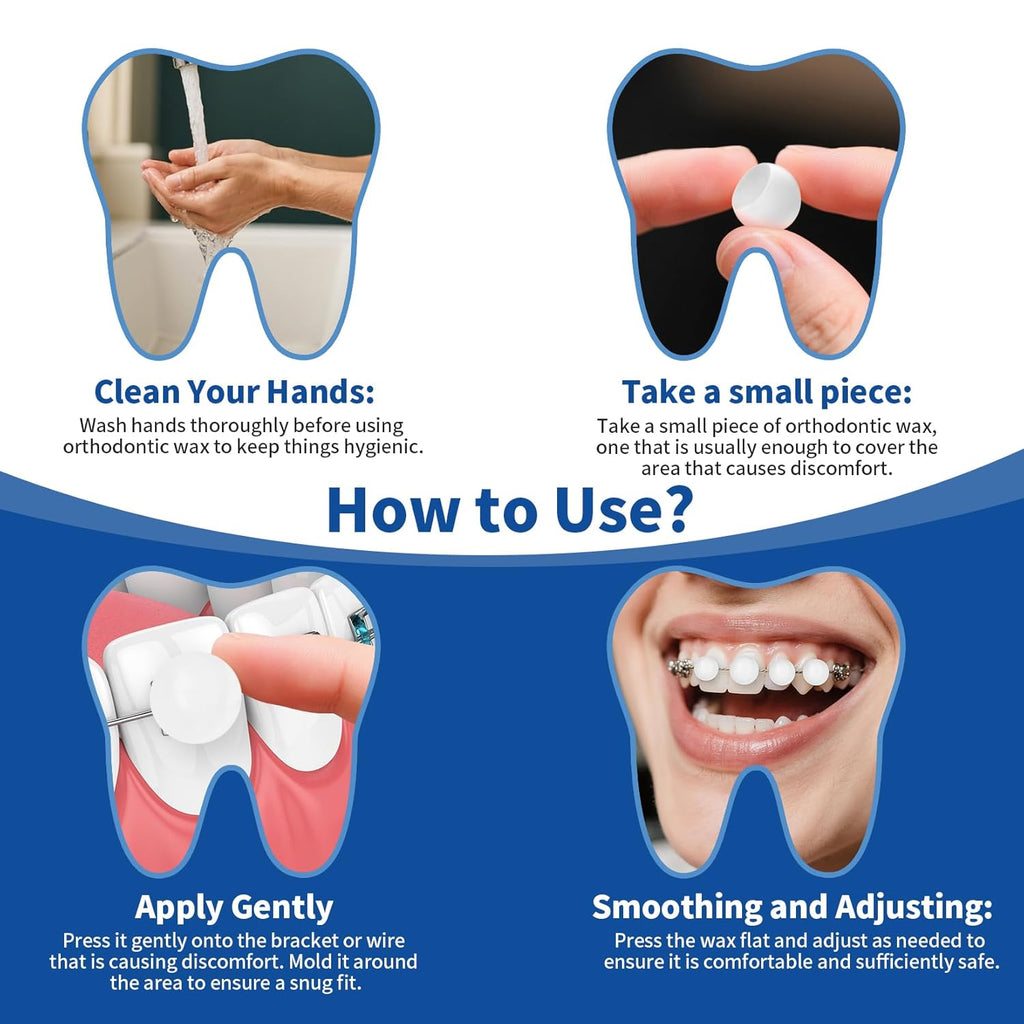 Orthodontic Wax for Braces - 180 Dental Wax Dots | Mint Flavor, Hygienic Individual Wraps, Brace Wax for Brackets