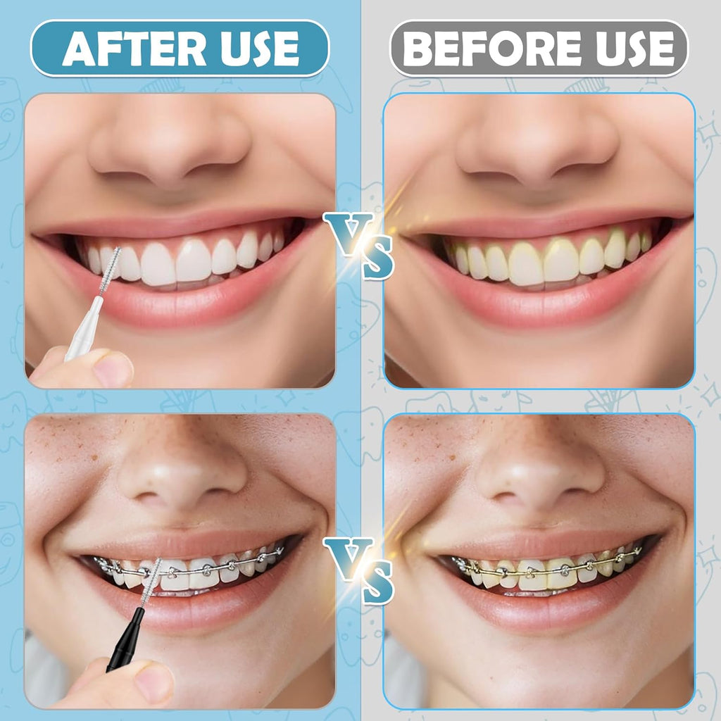 120 Pieces Interdental Brushes, Braces Brush Cleaner Orthodontic Flossers with Soft Bristles 360° Bendable Toothpicks Floss Picks for Braces Kit for Teeth Cleaning Tools