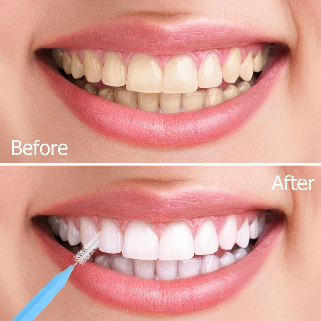 200Pcs Interdental Brushes Braces Toothbrush Teeth Gaps Cleaner Tools, 4 Color