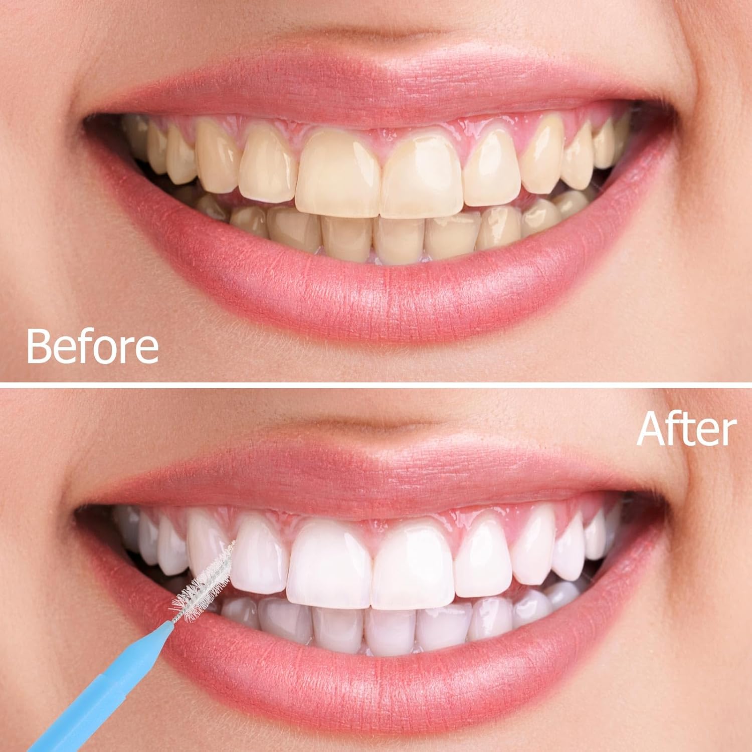 200Pcs Interdental Brushes Braces Toothbrush Teeth Gaps Cleaner Tools, 4 Color