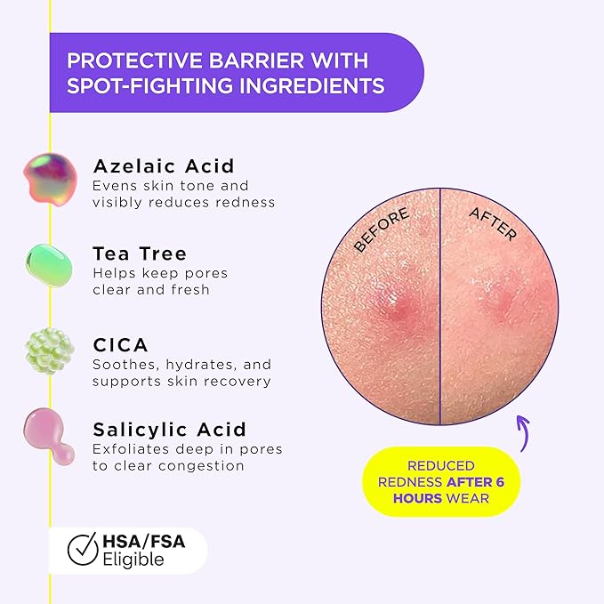 ZitSticka Liquid Pimple Patch - Invisible Pimple Patches for Face, Pimple Cream, Salicylic Acid Spot Cover For Face, Liquid Pimple Patch Large & Clear Fits to Makeup (0.3oz,10ml)