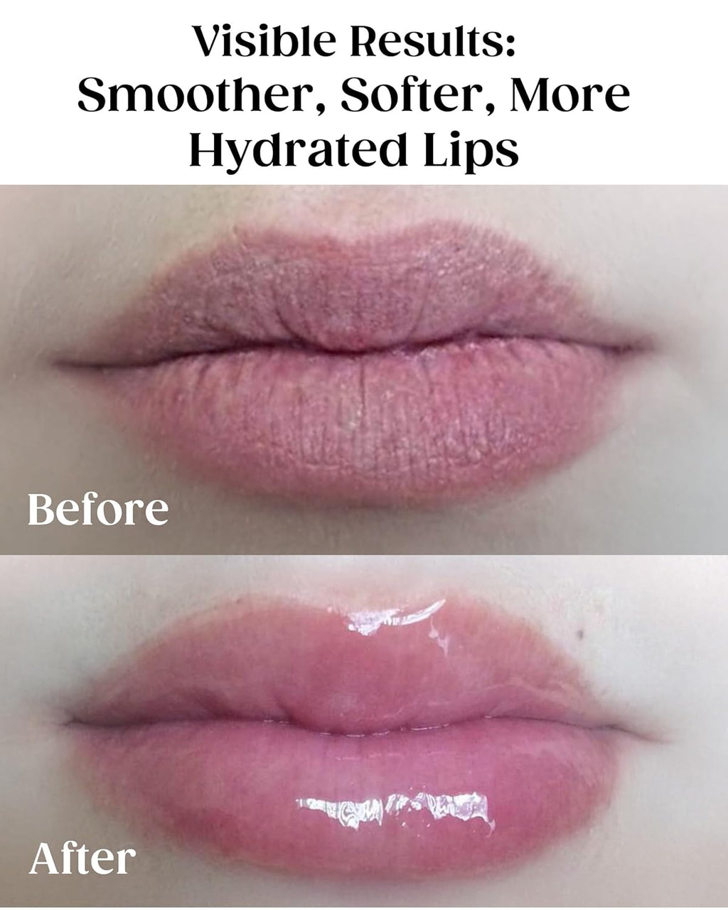 KAPLAN MD Perfect Pout Lip Mask & SPF 30 Lip Balm Duo – Hydrating Treatment with Hyaluronic Acid – Lip Mask (1 oz) + Pink Peony Balm (0.35 oz)