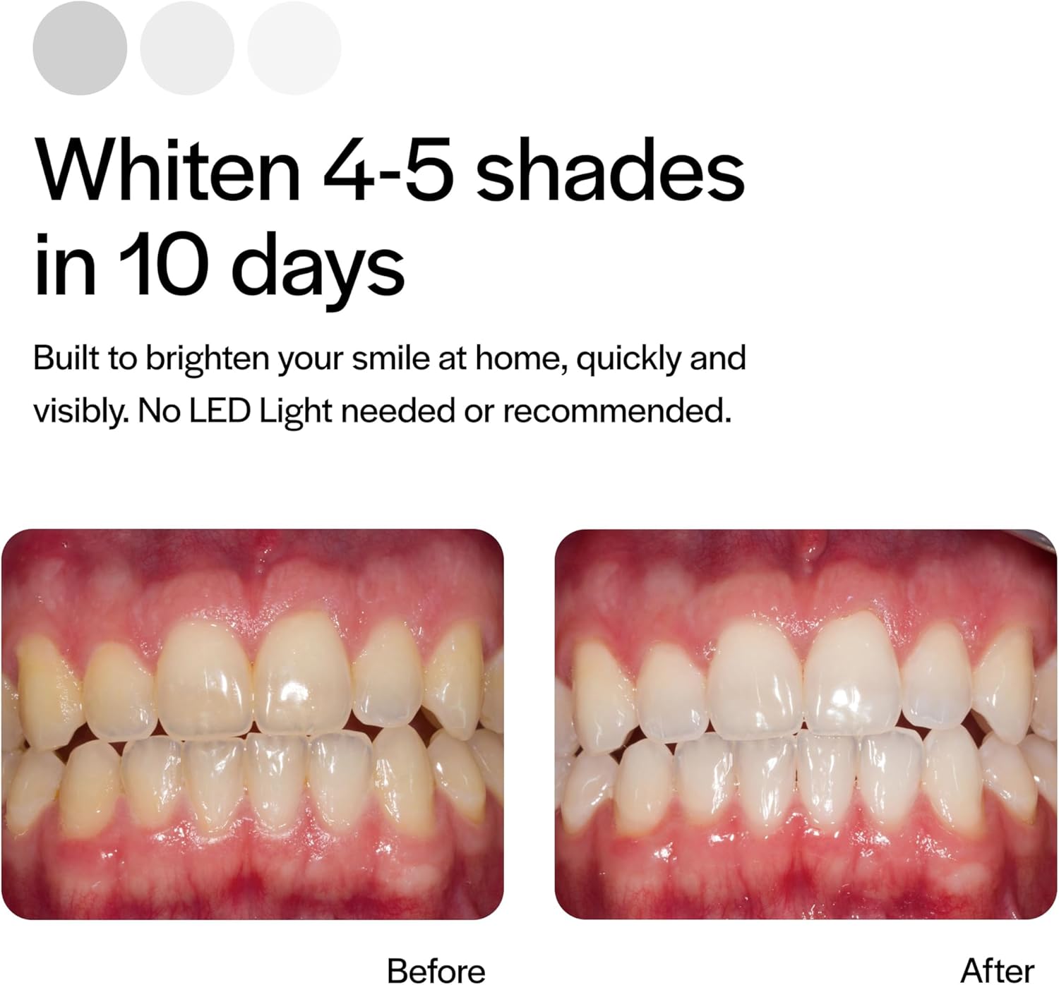 Opalescence GO 15 Whitening Bundle - (7 Treatments) Hydrogen Peroxide Prefilled Teeth Whitening Trays and Travel Sensitive Whitening Toothpaste 1 Oz - Mint Flavor- Includes a Toothbrush - 6288-1T