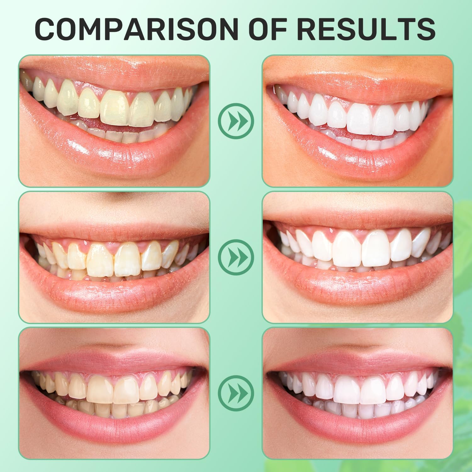 Spearmint White Oils Pulling Rinse-Natural Mouthwash with Organic Cold-Pressed Coconut Oil，White Oil Pulling Rinse for Teeth and Gums，Fresh Breath & Oral Care（2pc）