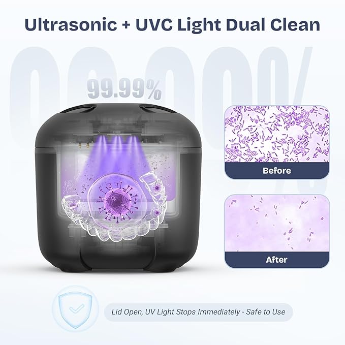 2025 Ultrasonic Retainer Cleaner- 45KHz 25W Portable Denture Cleaner with Drying Function and Removable Inner for Dentures, Mouth Guards, Aligners, Jewelry and More (Black)